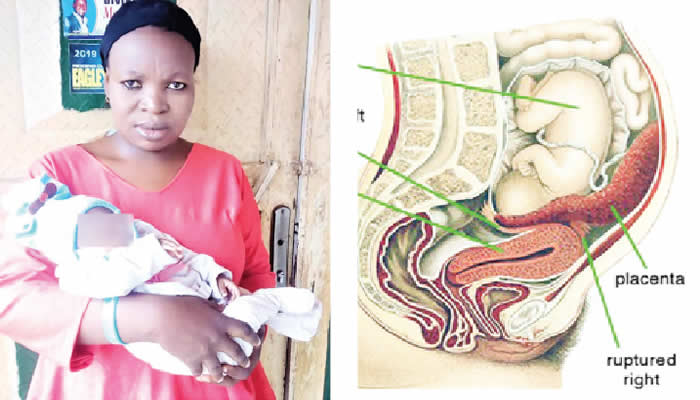 “I carried ectopic pregnancy for nine months without knowing, yet delivered a healthy baby girl”, says 36-year-old woman