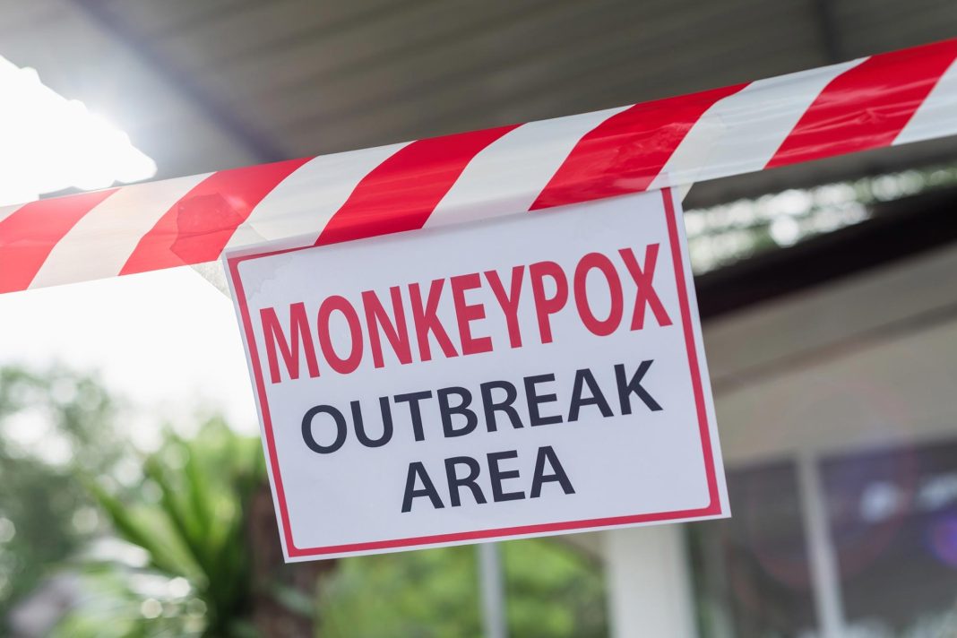 Monkeypox suspected cases rise to 141 in 13 States in Nigeria
