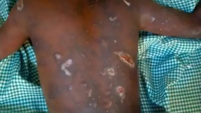 Police arrest woman for torturing 11-year-old maid to death
