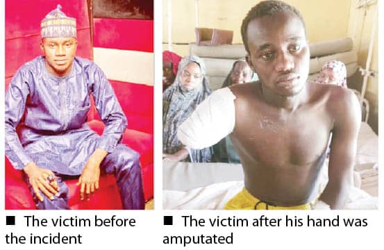 How peacemaker ended with amputated arm In Kano