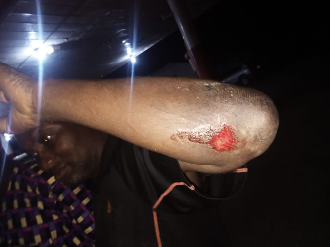 APC senatorial candidate, Tadese, alleges assassination, escapes