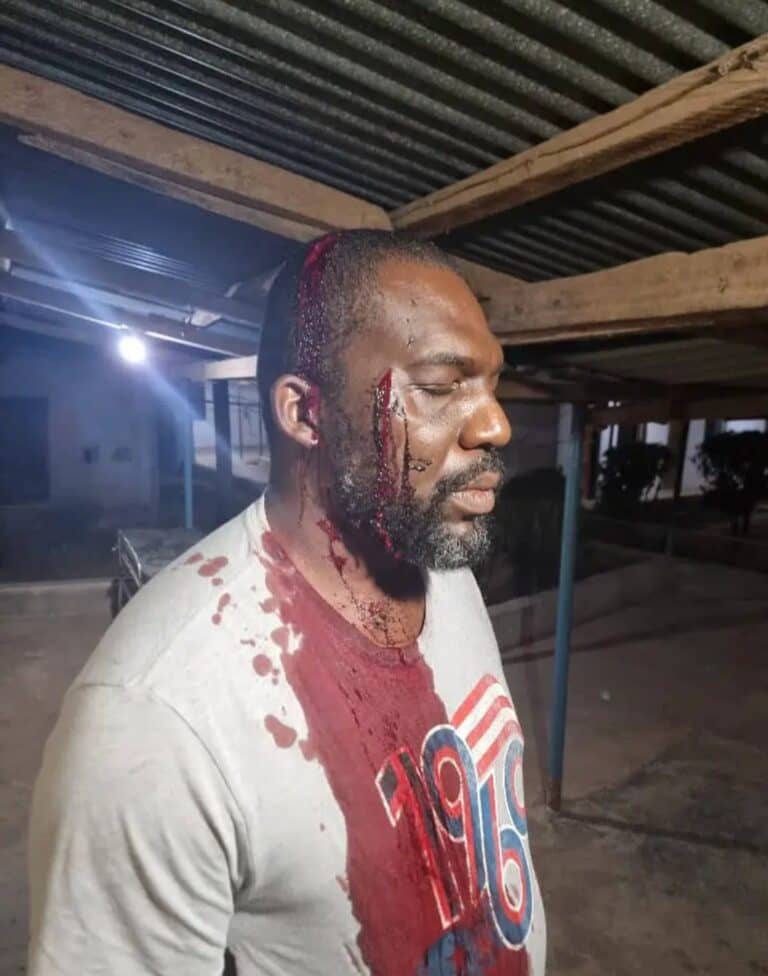 Soldiers batter face of House of Reps member in Benue