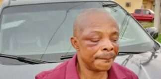 NLC president, Joe Ajaero, to be flown abroad for treatment