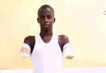 NBA, government kick over 12-year-old boy whose two hands were amputated for allegedly stealing phone