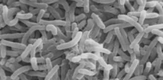 Two persons die, five others hospitalised as cholera outbreak ravages Badagry