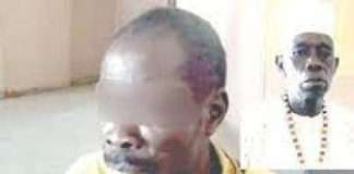 Man douses girlfriend with fuel, sets her ablaze during heated argument
