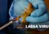 Lassa fever death toll rises to 172 across 21 states — NCDC