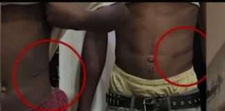 Doctor Arrested in Abuja For Alleged Kidney Trafficking Ring